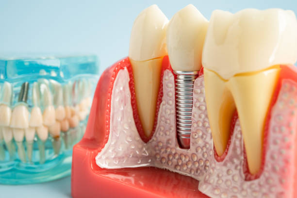 Best Dental Studio in Kenosha, WI